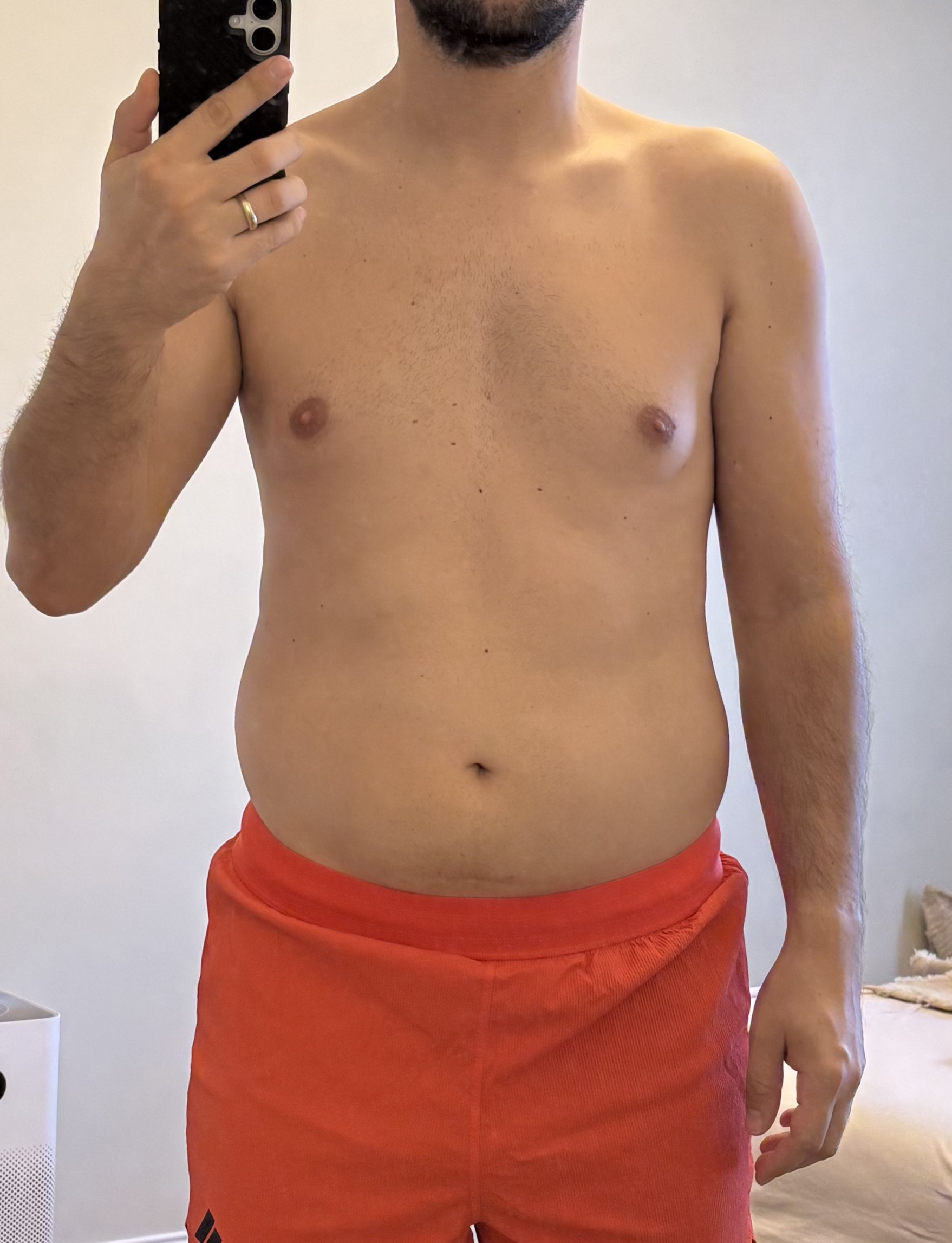 Progress photo 1 · May 2026 · Day one — nearly the same as ~91 kg in 2018