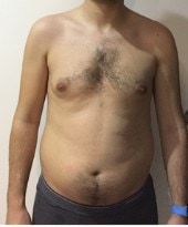 Progress photo 1 · 2018 · First beginning