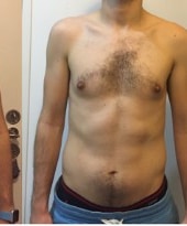 Progress photo 3 · 2018–2019 · Progress